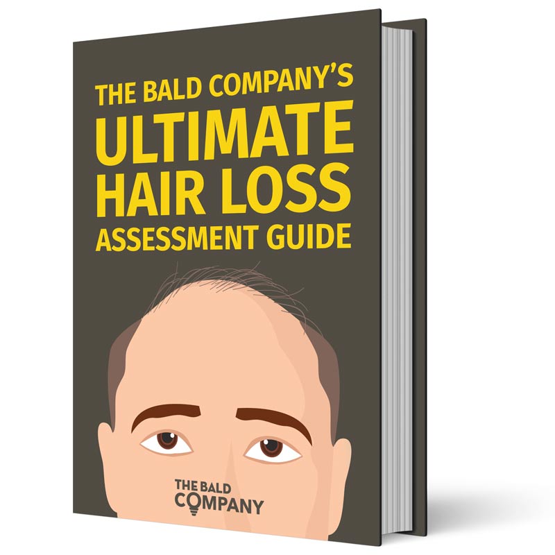How To Tell If Youre Going Bald The Bald Company