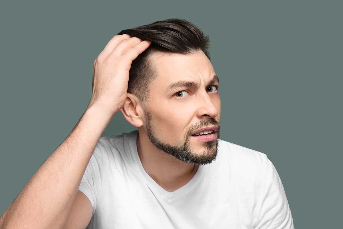 How To Tell If You're Going Bald | The Bald Company