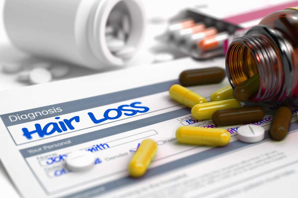 Hair-Loss-Facts-Myths-Statistics