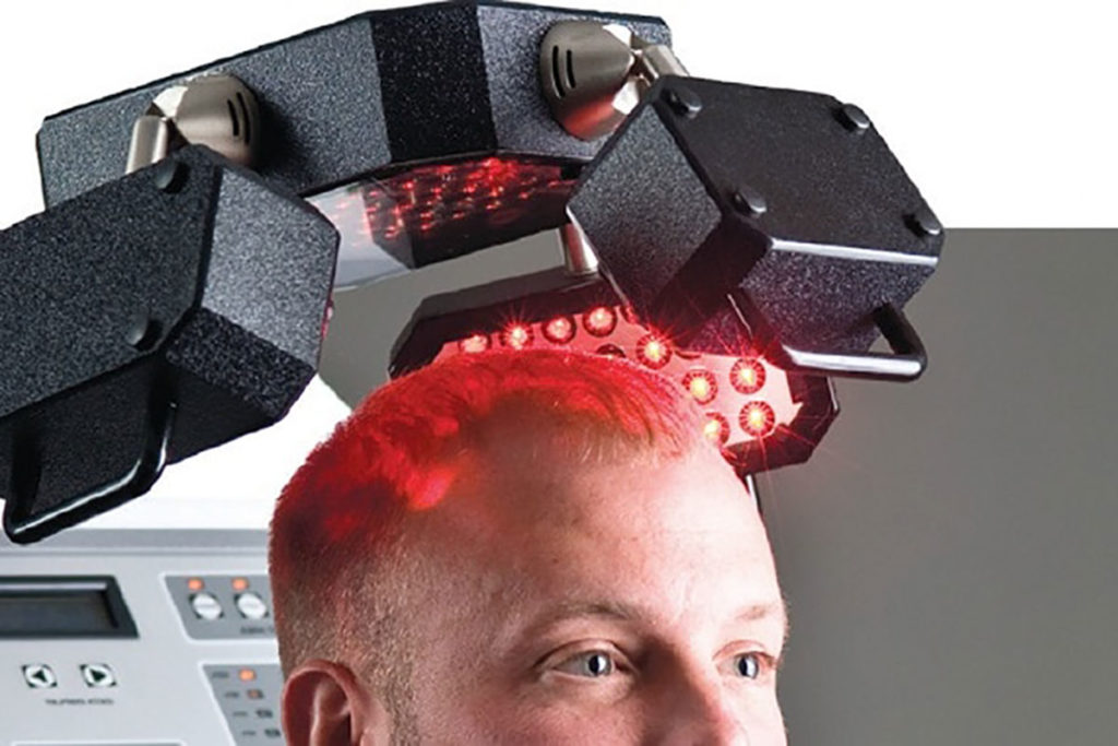 Low-Light Laser Therapy (LLLT) Hair Loss Treatment