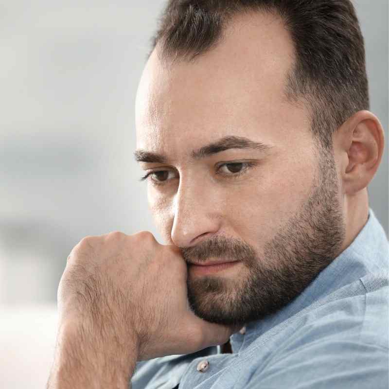 Mens-Hair-Loss-Cause-Stress