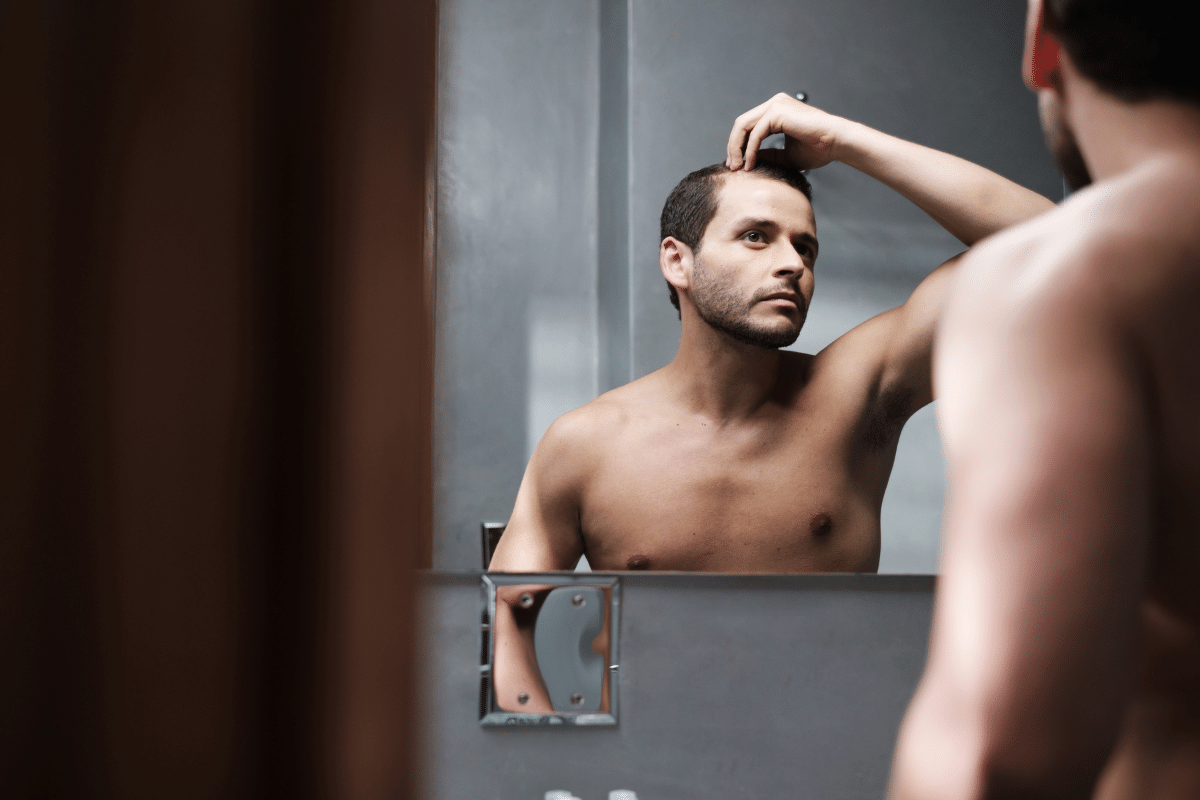 4 signs you are actually going bald