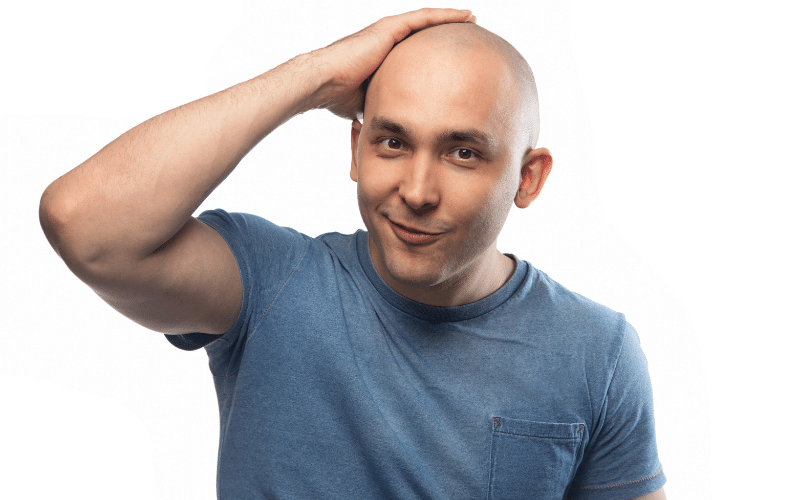 Acceptance Hair Loss - The Bald Company (1)