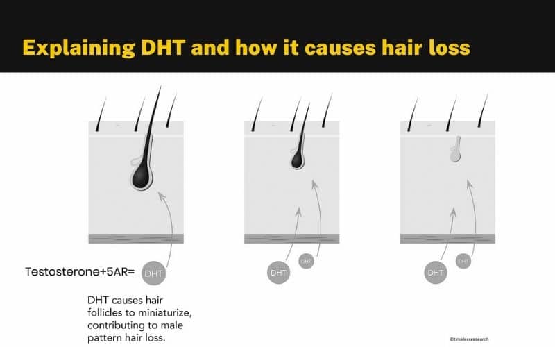 explaining-dht-hair-loss-balding-follicles-testosterone