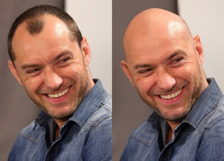 What Would I Look Like Bald | Bald Editor | The Bald Company