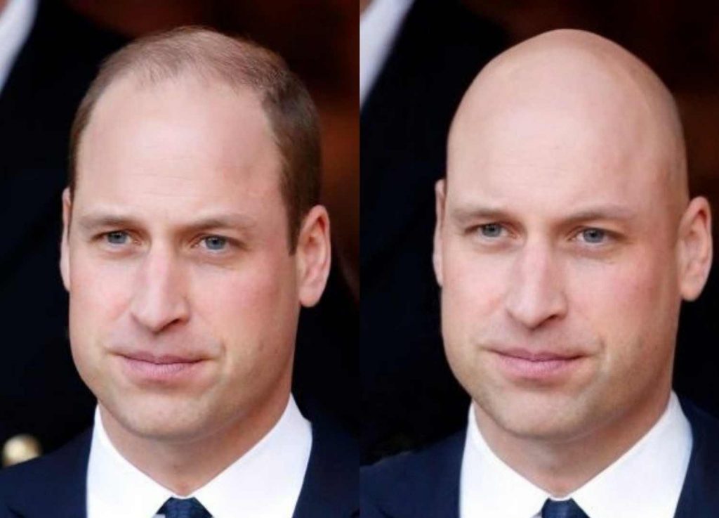 New Dating App For Bald People Aims To Help Destigmatize Hair Loss | Mix 97