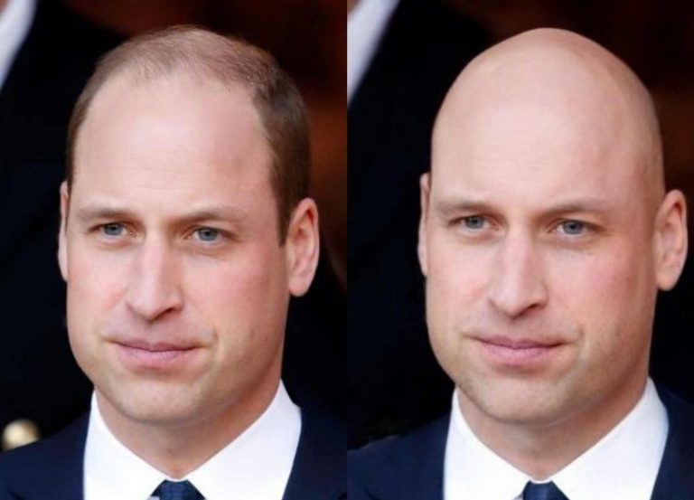 What Would I Look Like Bald | Bald Editor | The Bald Company