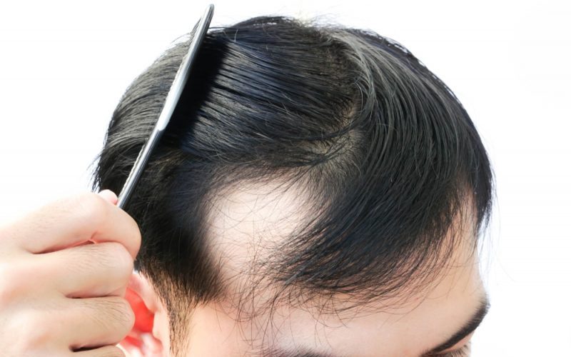 brushing hair loss how much is normal