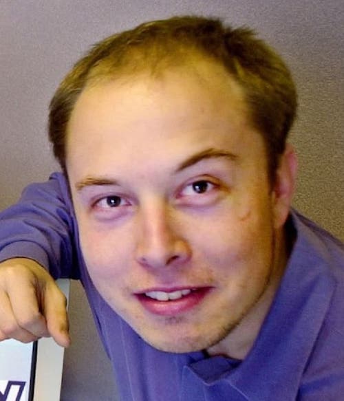 elon-musk-balding-hair-loss