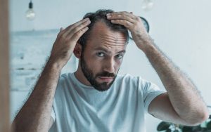 hairloss treatments balding best options solutions