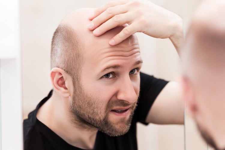 bald man checking for dandruff