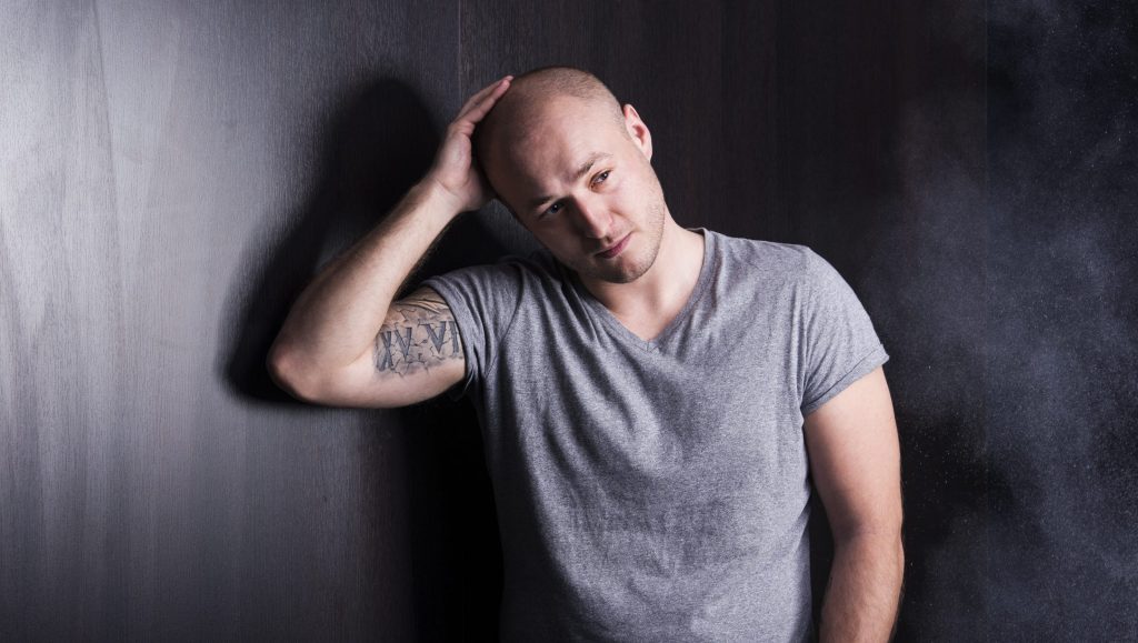 top 5 mistakes balding men make