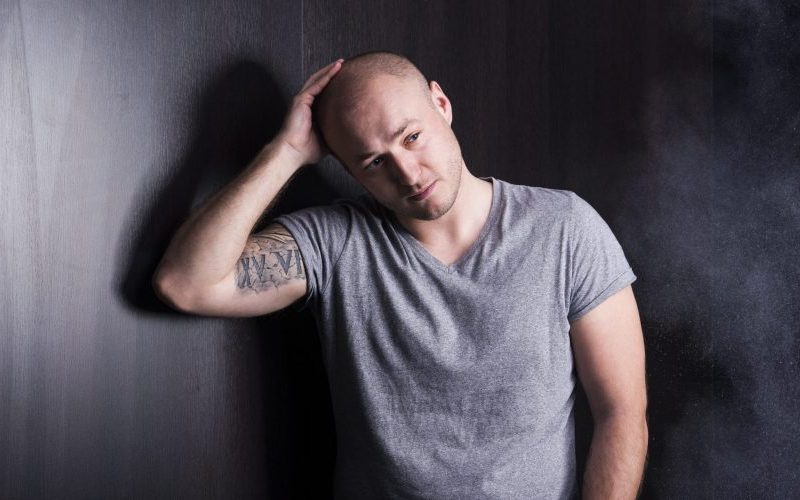 top 5 mistakes balding men make